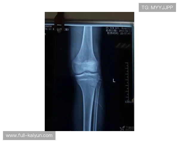 “穆西亚拉腓骨骨折康复进展，已参与球队合练”